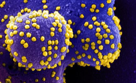Descubren variantes del coronavirus resistentes a anticuerpos neutralizantes