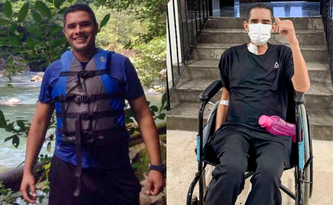 Marcos Daniel Morales Trujillo recibió un trasplante de hígado en el Hospital Universitario de Monterrey, Nuevo León (08/02/2025). Foto: Especial