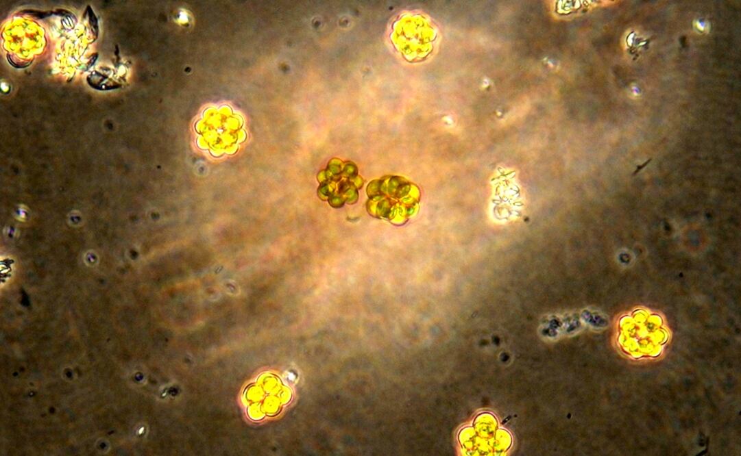 Algae colonies are pictured with a digital camera through a microscope after being collected from a tank at a waste-water treatment plant in Chiclana de la Frontera, near Cadiz - Photo: Jon Nazca/Reuters