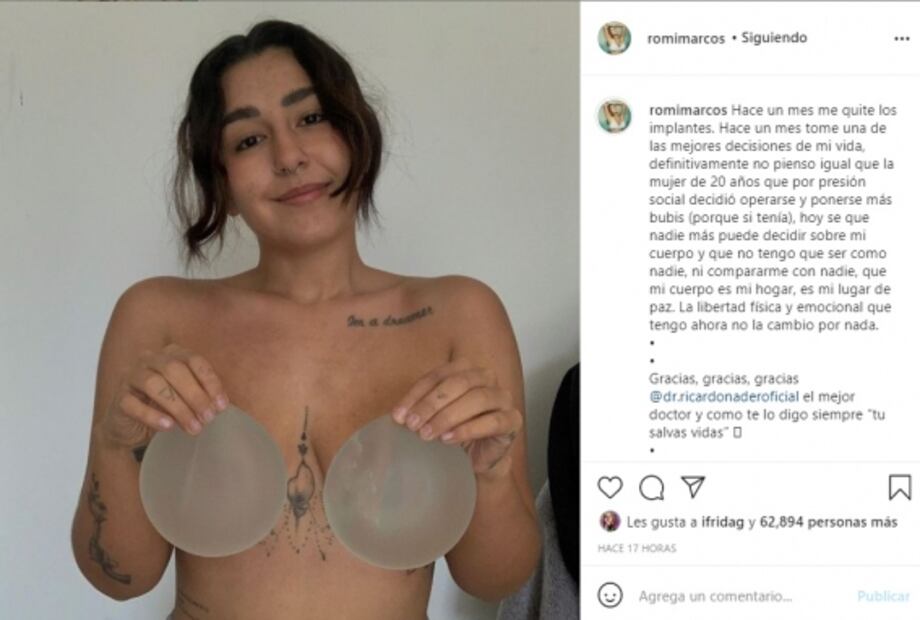 Romina, hija de Niurka, se quita los implantes de senos; reconoce que se operó por presión social 
