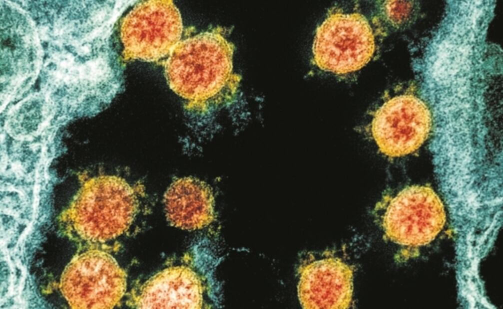 Si variantes del SARS-CoV-2 se vuelven más letales ¿el virus podría desaparecer?