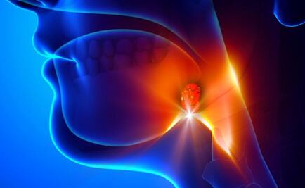 Gonorrea en la garganta, una amenaza desconocida