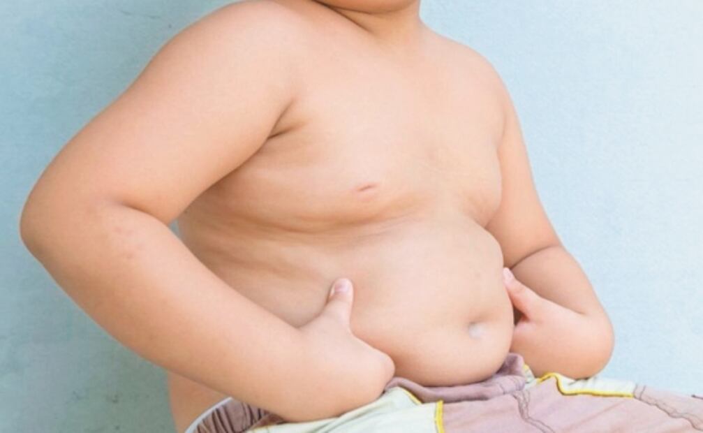 Junto a la covid-19, otra pandemia crece en México: la obesidad
