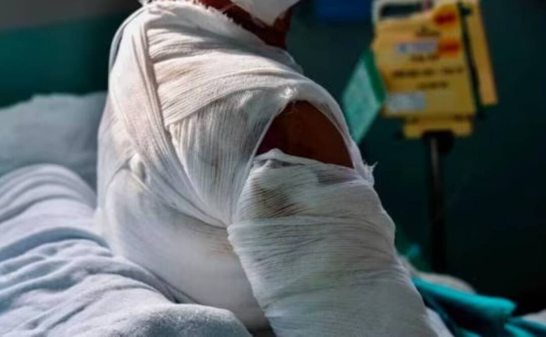 Tras la agresión, un vecino corrió a auxiliar a la víctima, a quien aventó una cubeta de agua con lo que logró apagar las llamas. Foto: Archivo El Universal