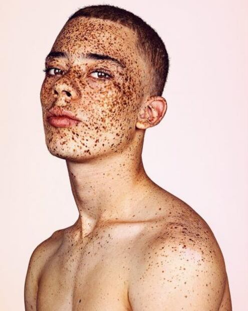 Este fotógrafo retrata a personas con pecas y se viraliza