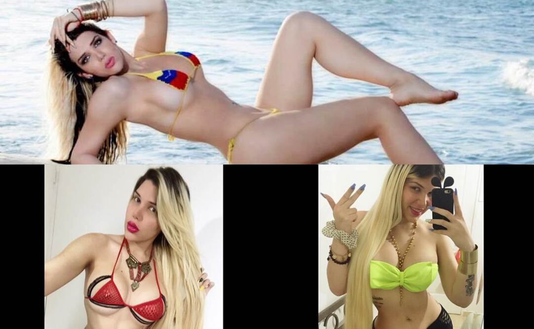 A los 19 años viajó a Caracas para colocarse senos, implantes en los glúteos y una sustancia que diera un aspecto más femenino a su mentón y a sus pómulos. FOTOS: Instagram 