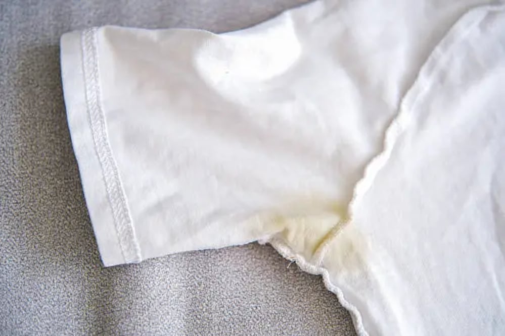 Los desodorantes tienen ciertos compuestos que manchan de color amarillo la ropa. Foto: Unsplash