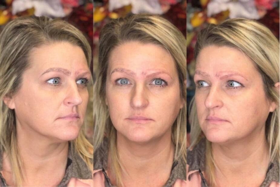 Mujer se hace microblading y le dibujan cuatro cejas