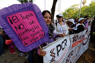 Lupus, una enfermedad de difícil diagnóstico