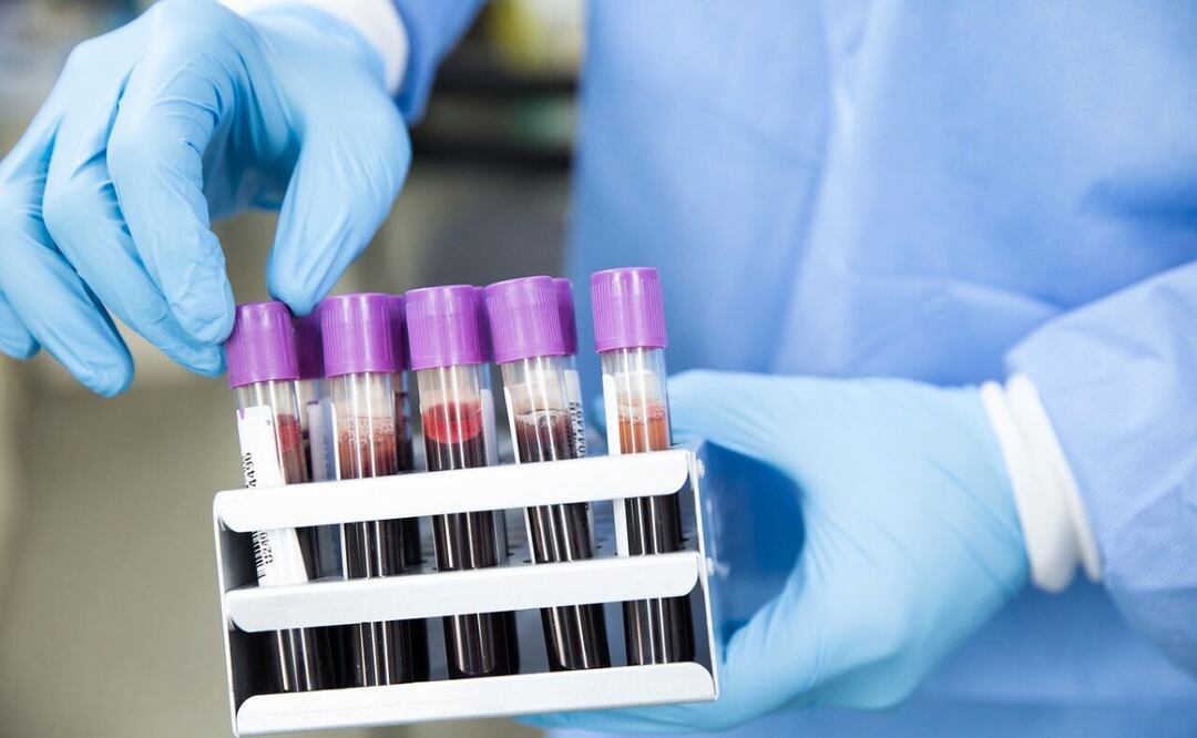 Alfalfa y sangre. Fuente: Pixabay