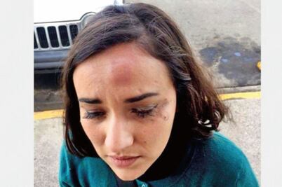 Protección para periodistas atacados: CNDH