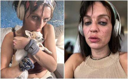 Video de Camilo Blanes, hijo de Camilo Sesto, revela su lamentable estado físico y mental