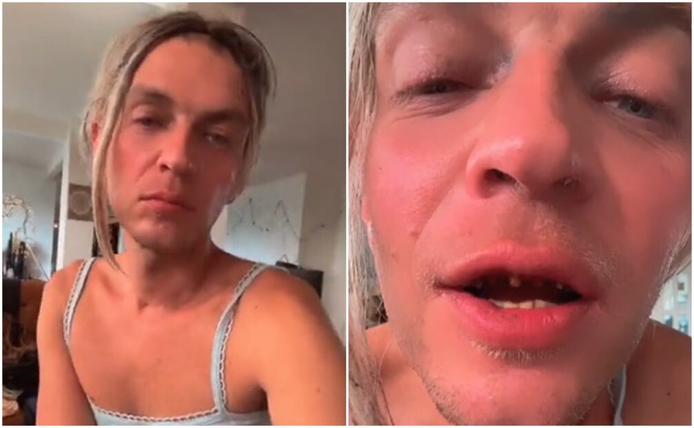 Camilo Blanes, hijo de Camilo Sesto, reaparece muy desmejorado y alerta en redes