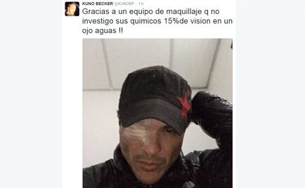Kuno Becker pierde visión en un ojo durante rodaje
