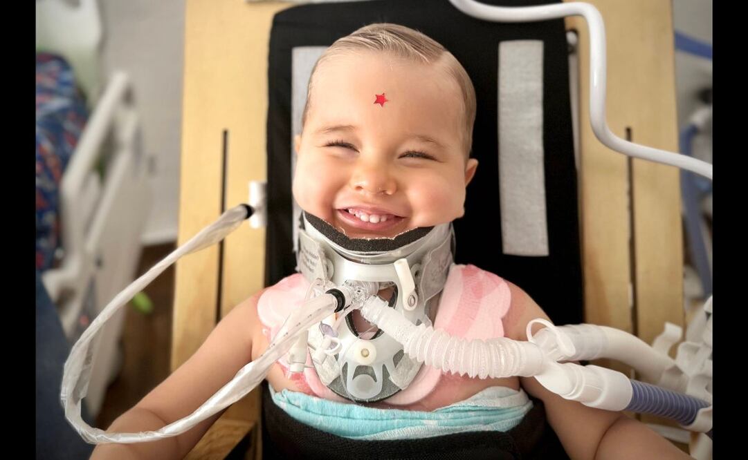 Además de la mejoría que presentó contra todo pronóstico, el pequeño Oliver también resalta entre los casos de lesiones de médula espinal por la sonrisa que mantiene a pesar de lo que ha vivido. Foto: Cortesía Familia Staub.