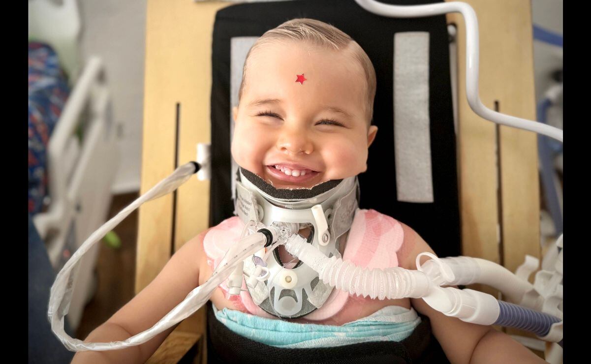 Además de la mejoría que presentó contra todo pronóstico, el pequeño Oliver también resalta entre los casos de lesiones de médula espinal por la sonrisa que mantiene a pesar de lo que ha vivido. Foto: Cortesía Familia Staub.