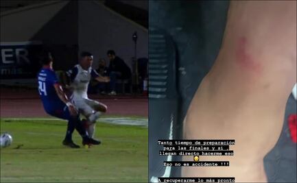 Liga de Expansión MX: ¿Fueron a fracturar a al “Hobbit” Bermúdez?