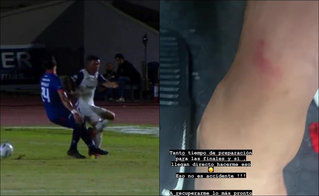 La dura lesión del Hobbit Bermúdez / Foto: Especiales