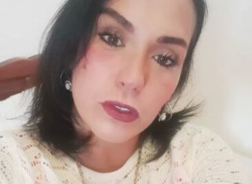 Mayela Laguna fue brutalmente golpeada en Acapulco; está hospitalizada