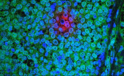 Identifican proteínas que podrían curar cánceres como la leucemia