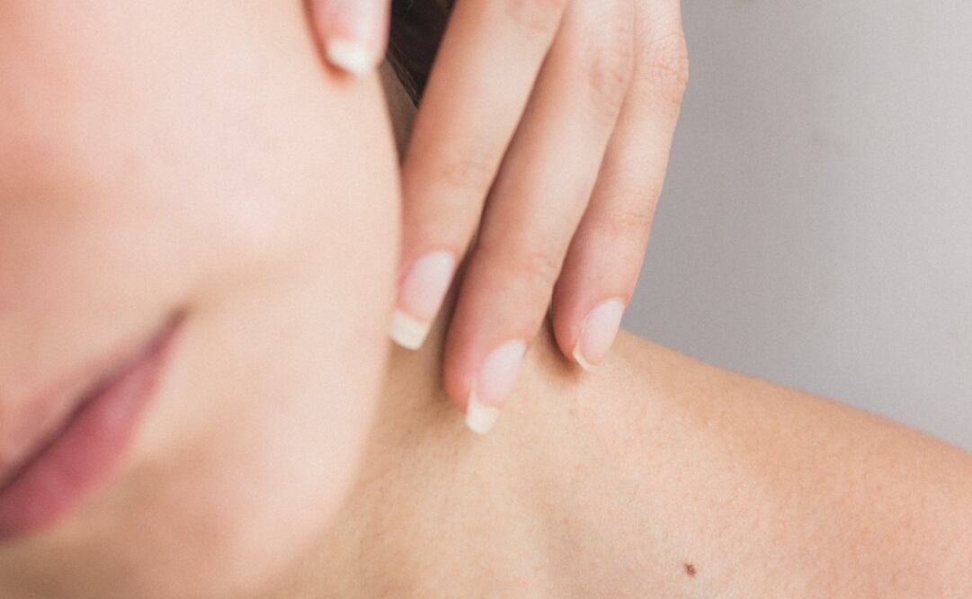 Flacidez en la piel | Foto: Pinterest