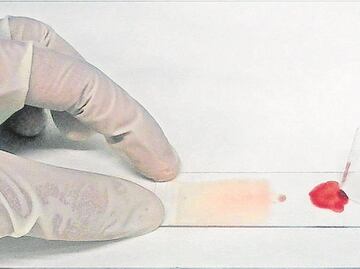La malaria ya existía en el Imperio Romano