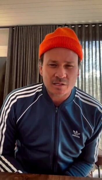 Blink-182: Travis Barker sube impactante fotografía de la operación en su dedo tras cancelación de gira 