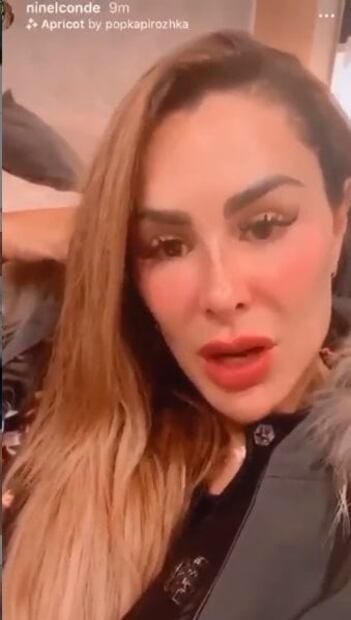 Llama la atención rostro de Ninel Conde, "era bonita", dicen cibernautas