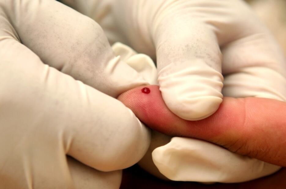 Una nueva prueba de sangre detectará el Alzheimer en sólo dos días 