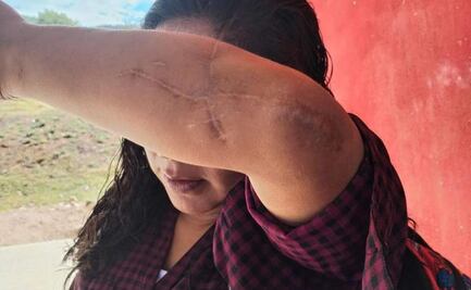 Guillermina López sobreviviente de intento de feminicidio denuncia que juez busca reclasificar delito; fue atacada con un hacha