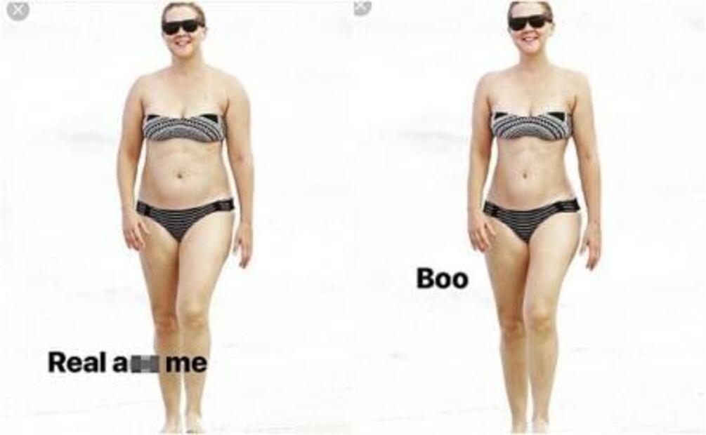 Retocan el cuerpo en bikini de Amy Schumer y ella responde 