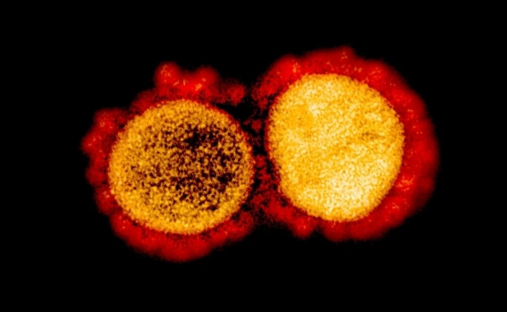 Síntomas del Covid-19 en embarazadas duran hasta más de dos meses