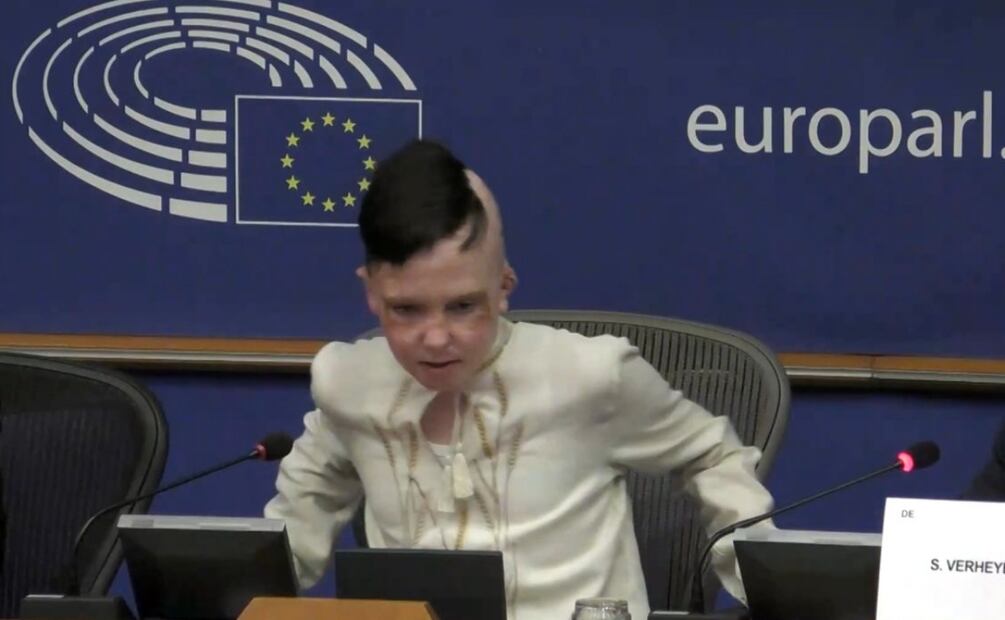 Roman, niño de 11 años de Lviv que sobrevivió a un ataque con misiles rusos. Foto: Captura de pantalla