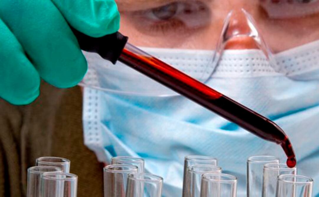 En Cieni existe un grupo de investigadores desarrolla diferentes protocolos de investigación que permitan generar conocimiento que aporte a la búsqueda de una cura a la infección. FOTO: Archivo /EL UNIVERSAL