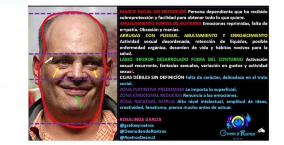 "Obsesivo y con sobreprotección", así sería la conducta de Coco Levy según especialista