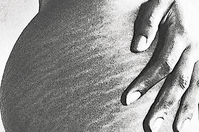 Alicia Keys "presume" sus estrías en Instagram