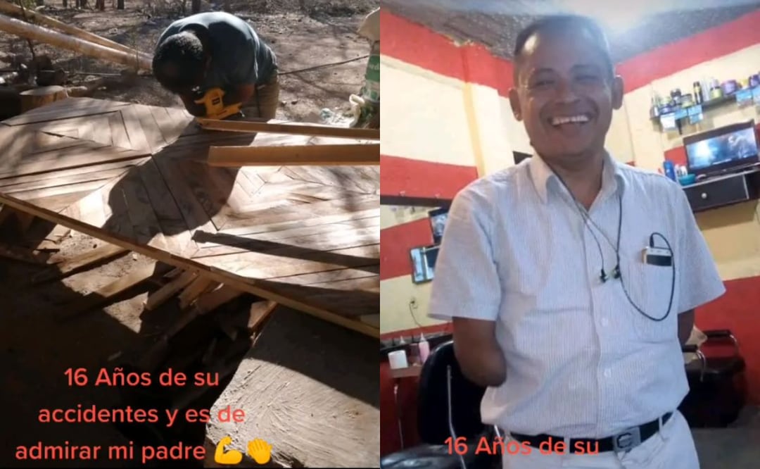 Hace aproximadamente 16 años tuvo un accidente en el cual está hombre perdió sus brazos. Foto: Captura de video