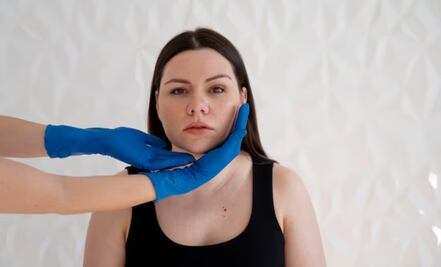 Descubre el remedio para disminuir la papada y los cachetes sin cirugías