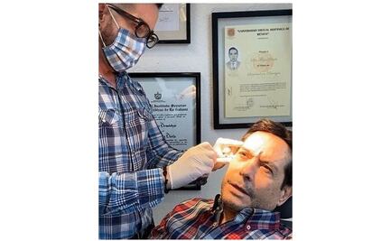 Pepillo Origel y su sesión de bótox