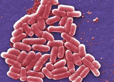 Reporta EU primer caso de bacteria resistente a antibióticos