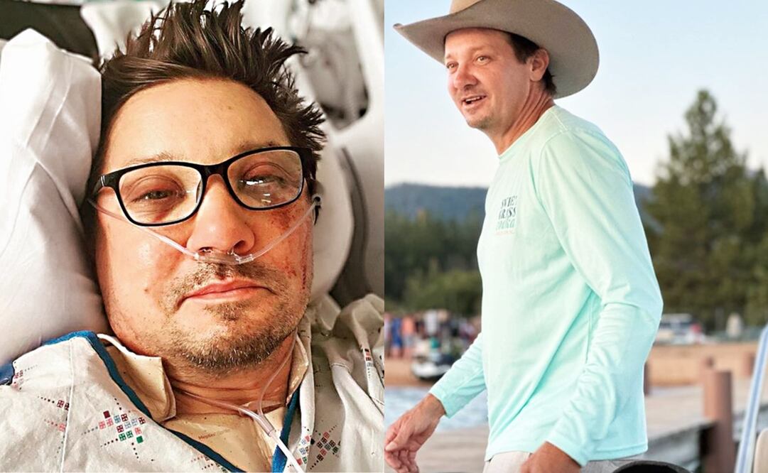 Jeremy Renner sufrió un accidente que lo dejó con 35 huesos rotos y otras lesiones de alta gravedad.
Fotos: Instagram