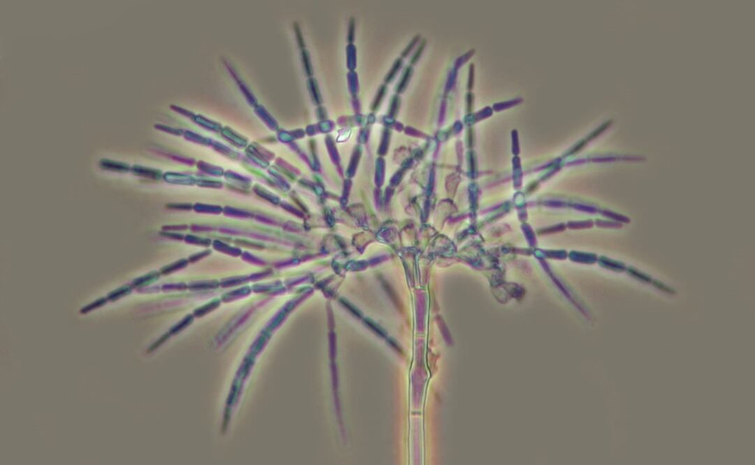 Hongo microscópico saprobio 'Speirosis scopiformis' visto a través del microscopio. Foto: (AMC)