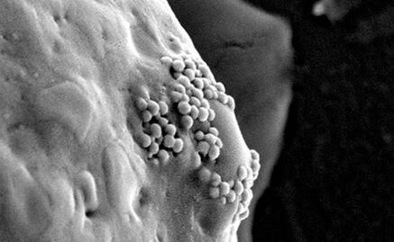 Descubren nanoburbujas explosivas que pueden matar células cancerígenas