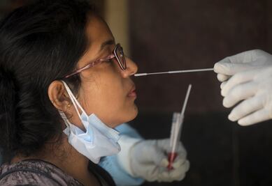 Personas que contrajeron Covid-19 tiene más riesgo de sufrir problemas neurológicos y siquiátricos: estudio