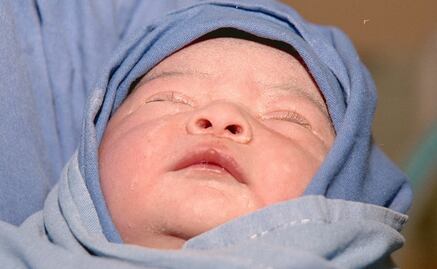 Niños por reproducción asistida son más enfermizos