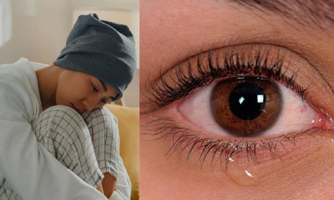 Una mujer en Colombia sufre una extraña condición por la cual derrama sangre por los ojos. FOTO: ESPECIAL