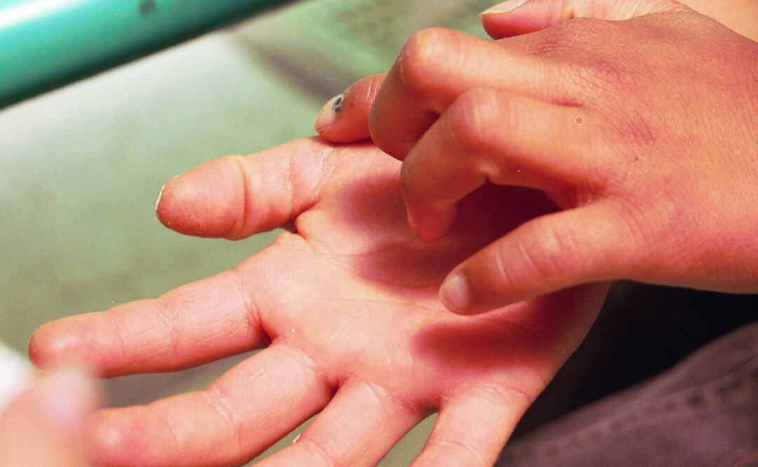 (FOTO: ARCHIVO EL UNIVERSAL)