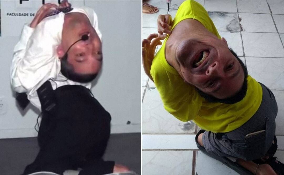 Claudio Vieira es residente de Brasil. Haber nacido con la cabeza al revés no lo detuvo para cumplir su sueño de ser predicador. Foto: Instagram @claudio_viera_de_oliviera