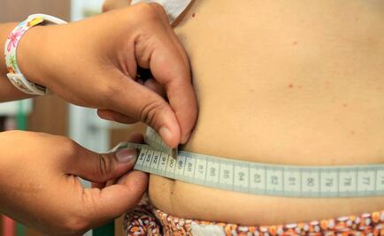 Obesidad causa pérdida de 10 años de esperanza de vida