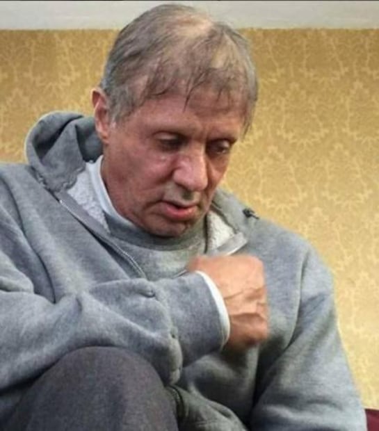 Las fotos de Sylvester Stallone que impactaron